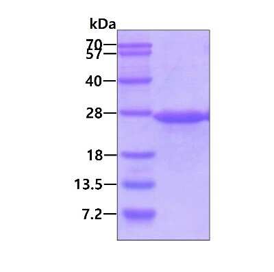 SDS-PAGE: Recombinant Human ATP5O His Protein [NBP1-50931]